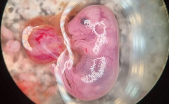 Scientists Are Growing Human Organs In Animals—And It’s Working